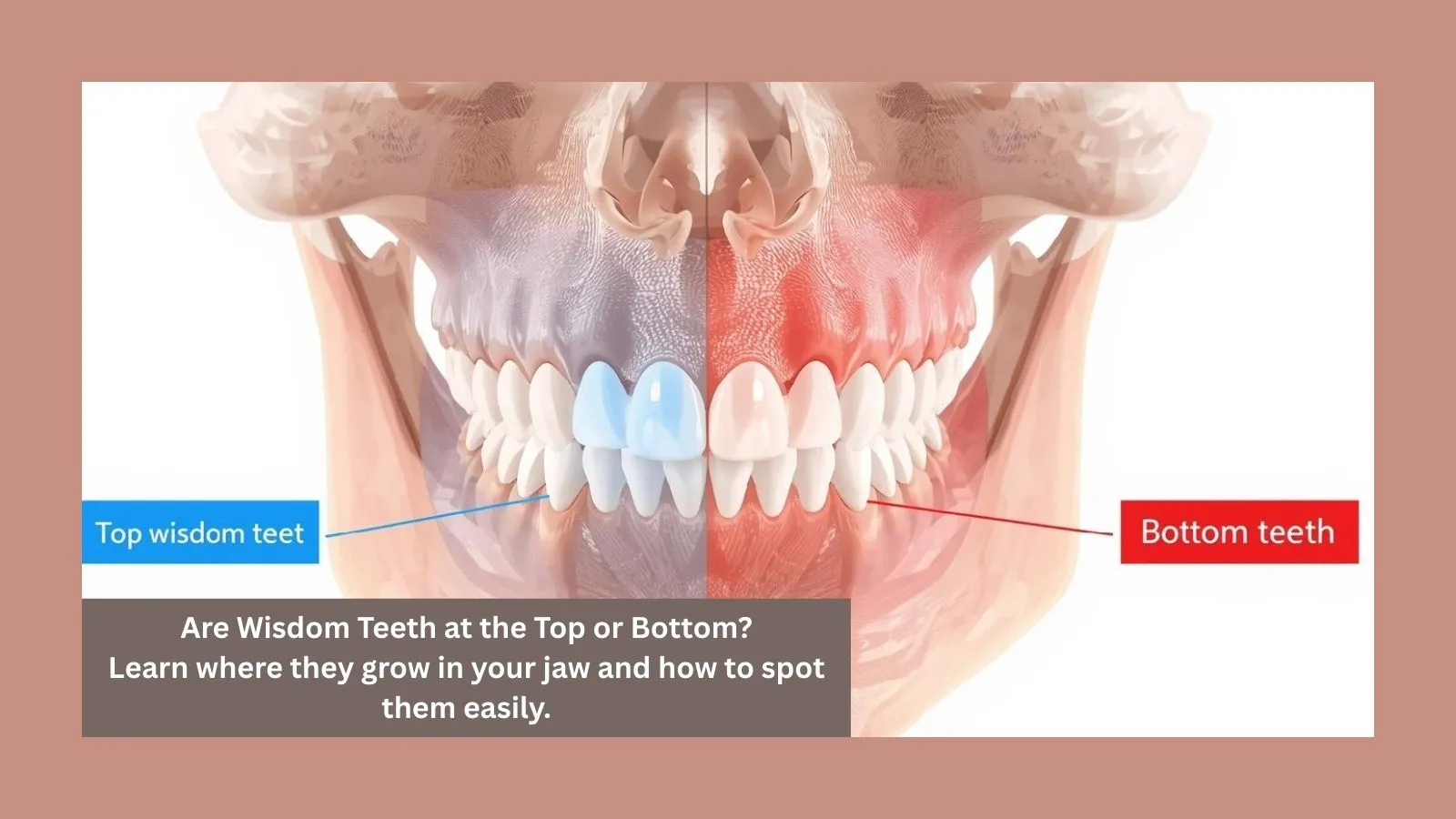 Are Wisdom Teeth at the Top or Bottom