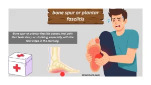 bone spur or plantar fasciitis